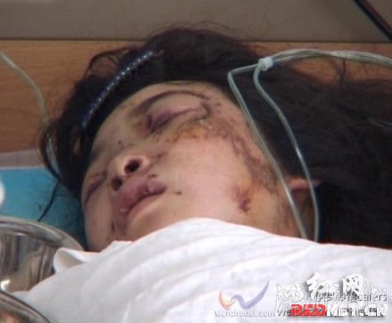 小女孩安安（化名）在湖南省桑植縣中醫(yī)院的病床上靜靜地躺著