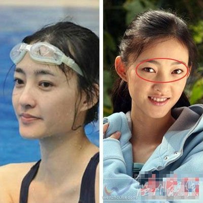 王麗坤整容照片疑割雙眼皮她本人不承認(rèn)