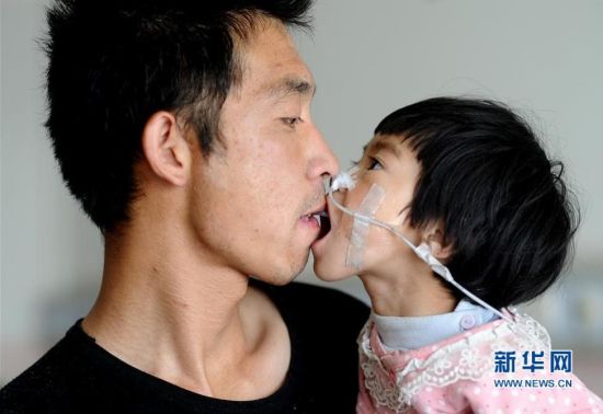 患病女兒無法進食 父親嘴對嘴喂食女兒