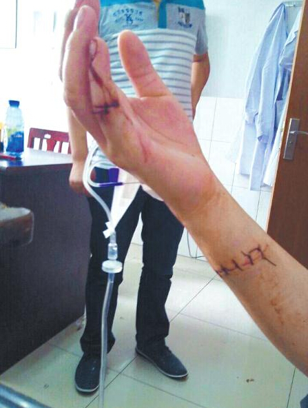 拒陪室友聊天被劃傷5刀