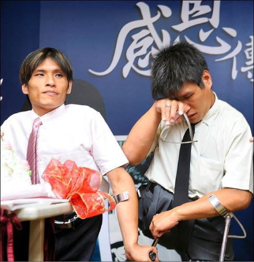 臺灣連體兄弟
