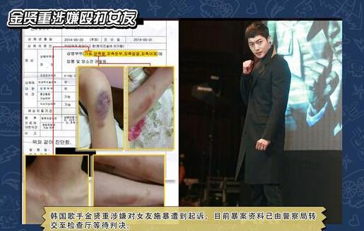 金賢重毆打女友a(bǔ)某致其骨折