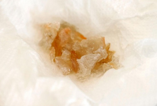 瑞安出現(xiàn)注膠蝦