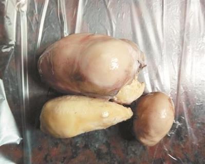 女子殺雞發現雞寶