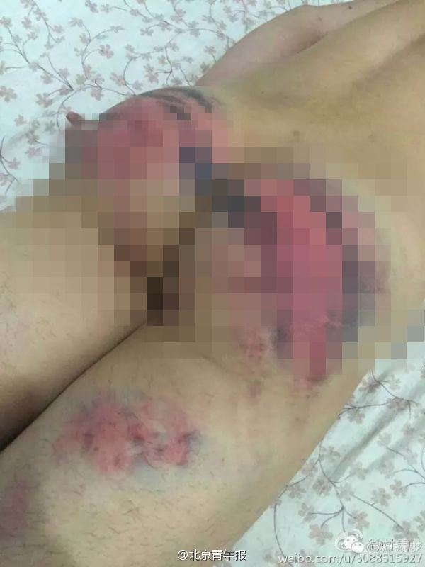 學生屁股被打開花