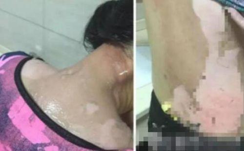 開水潑女顧客案續