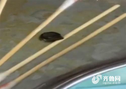 男童眼中發現電池