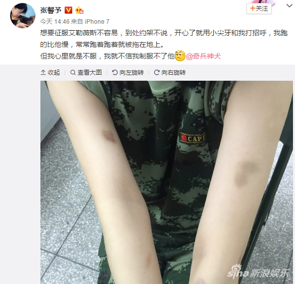 張馨予訓(xùn)狗慘被咬