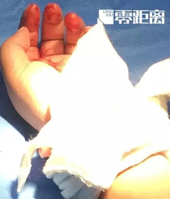 兒子被咬摔死泰迪 愛狗人士殺人