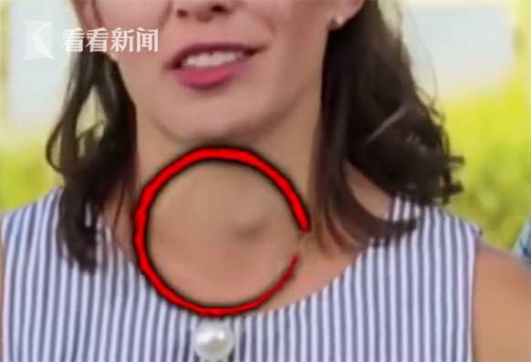 看電視發現患腫瘤