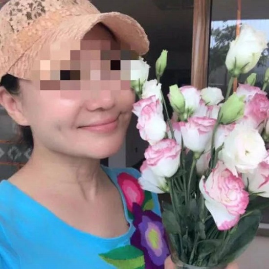 60歲老賴(lài)整成少女，頸部的皺紋暴露了老年的秘密