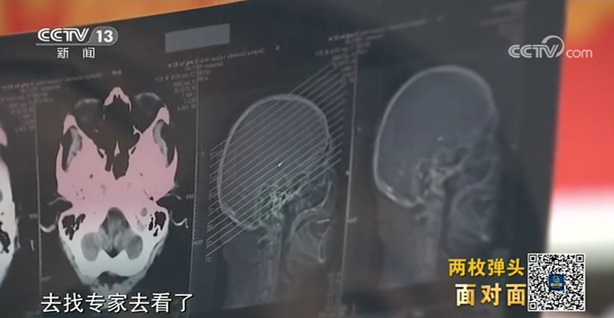 抗美援朝老兵骨灰里發現子彈頭