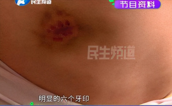 安陽(yáng)王新剛被停職 河南安陽(yáng)惡犬咬人王新剛狗仗人勢(shì)